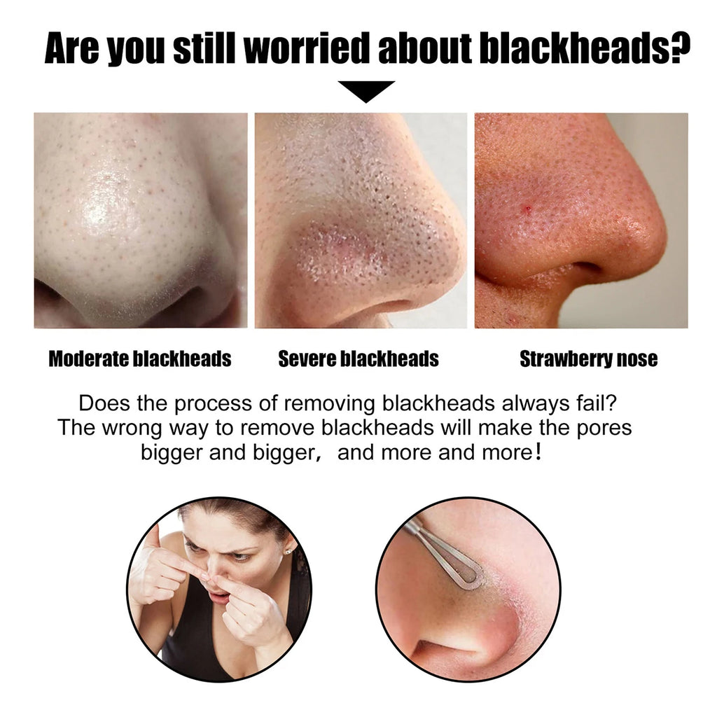 Blackhead Nose Strips Deep Pore Cleansing Patch | 10–50 Pack Nose Pore Strips QXL