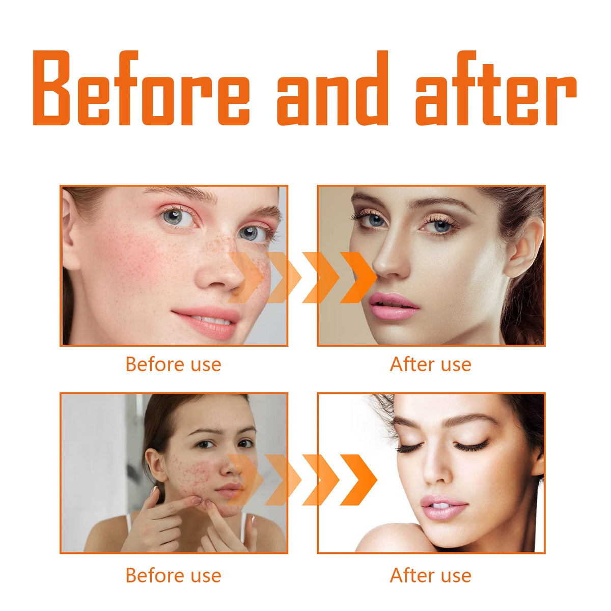 Turmeric Radiant Face Toner – Brightening & Hydrating 100ml Face Toner QXL