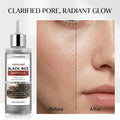 Black Rice Exfoliating Serum | Pore Minimizer & Brightening Exfoliating Face Serum QXL 100ml