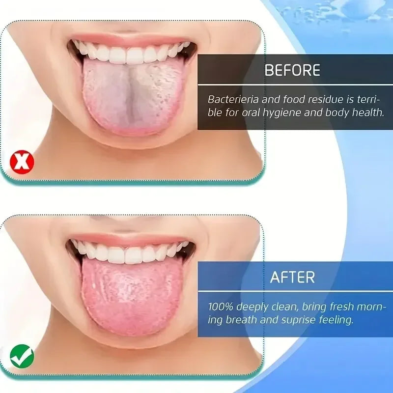 U-Shaped Stainless Steel Tongue Scraper | 4 Colors Tongue Scraper QXL