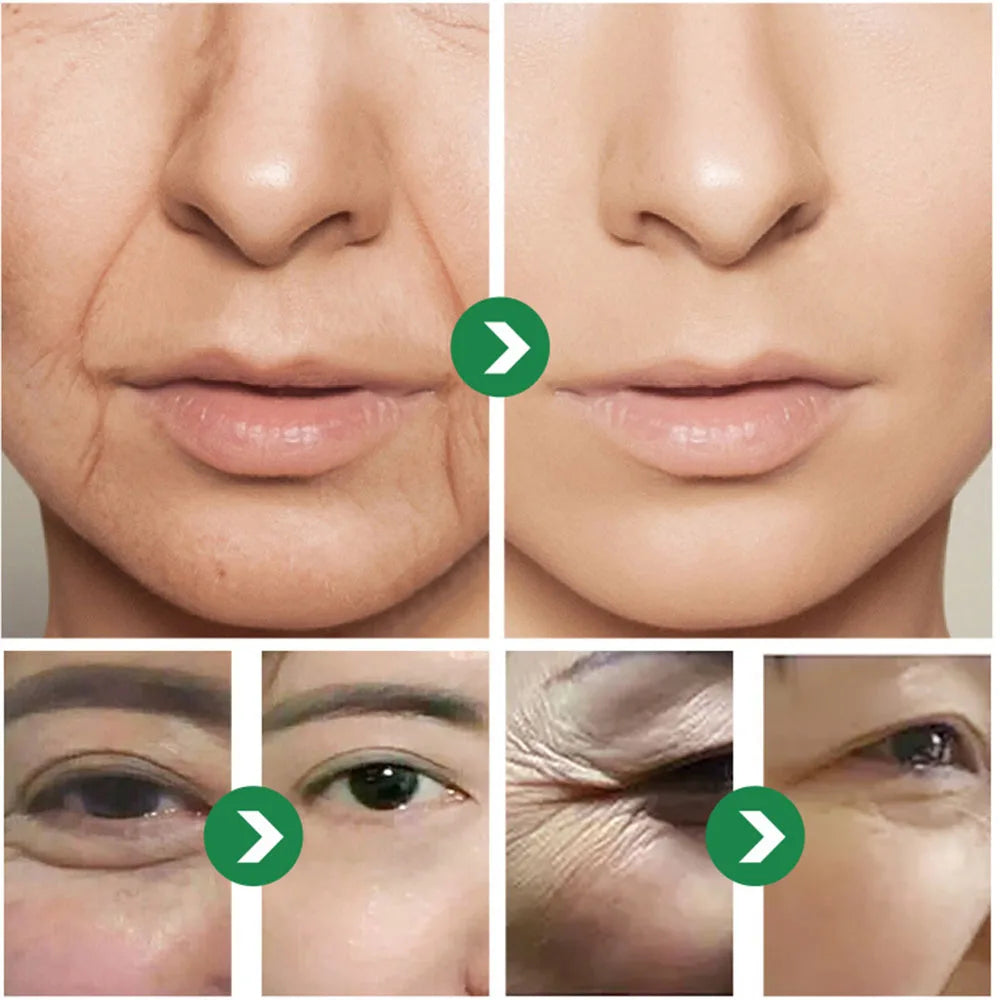 Japanese Six Peptide Face & Eye Cream – 50ml Moisturizing Peptide Face Cream QXL