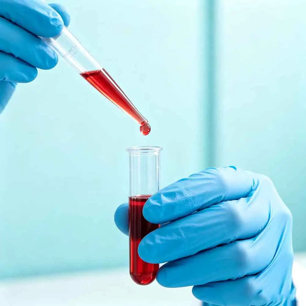 100-Pack 3ml Disposable Graduated Transfer Pipettes | Dropper Disposable Transfer Pipettes QXL