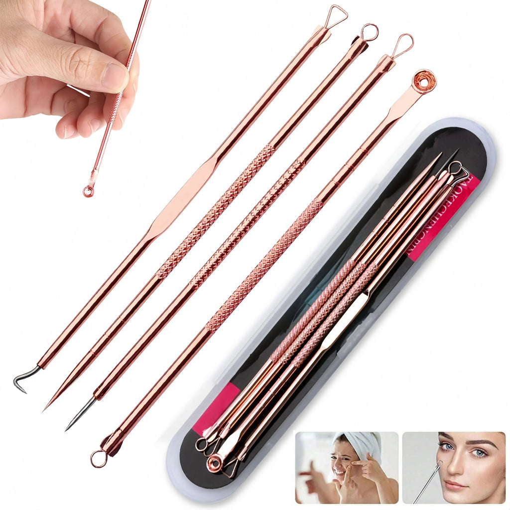 4-Piece Blackhead Comedone Extractor Kit – Stainless Steel Tools Comedone Extractor Kit QXL
