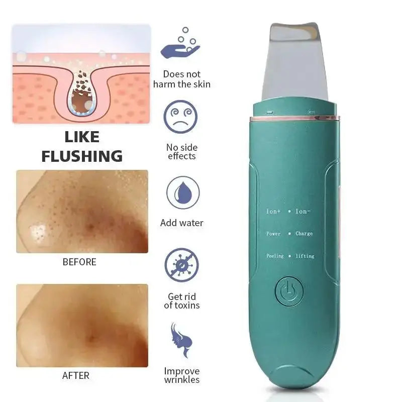 Ultrasonic Facial Cleanser | Ionic Pore Cleaner & Skin Scrubber Facial Cleansing Device QXL