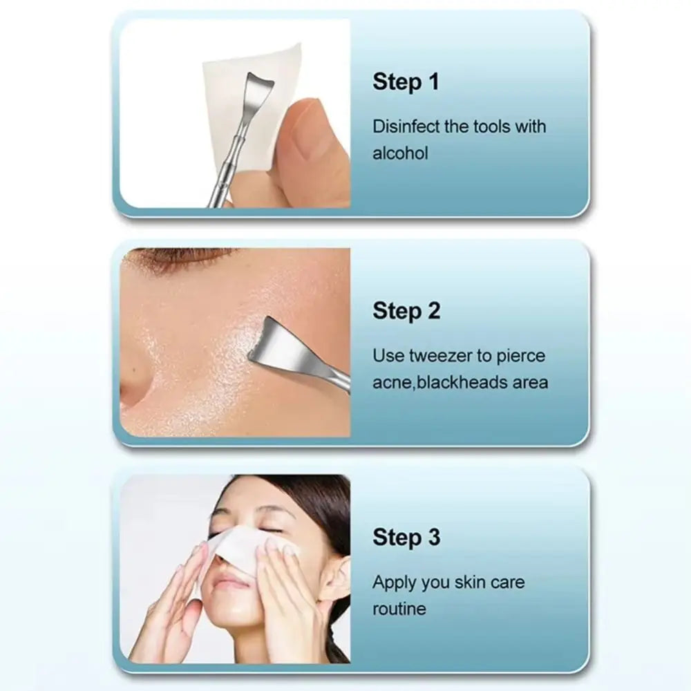 3-Pack Double-Head Stainless Steel Blackhead Extractor Tool Blackhead Extractor Tool QXL
