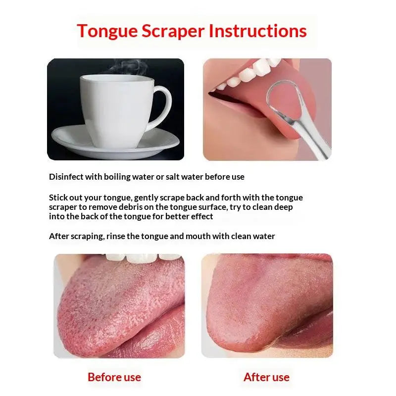 Stainless Steel Tongue Scraper Set | Fresh Breath Adults Tongue Scraper Set QXL