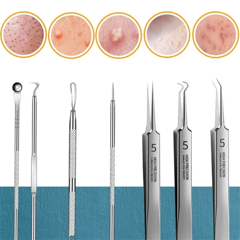 11-Piece Blackhead Extractor Tool Kit | Stainless Steel Set Blackhead Extractor Kit QXL