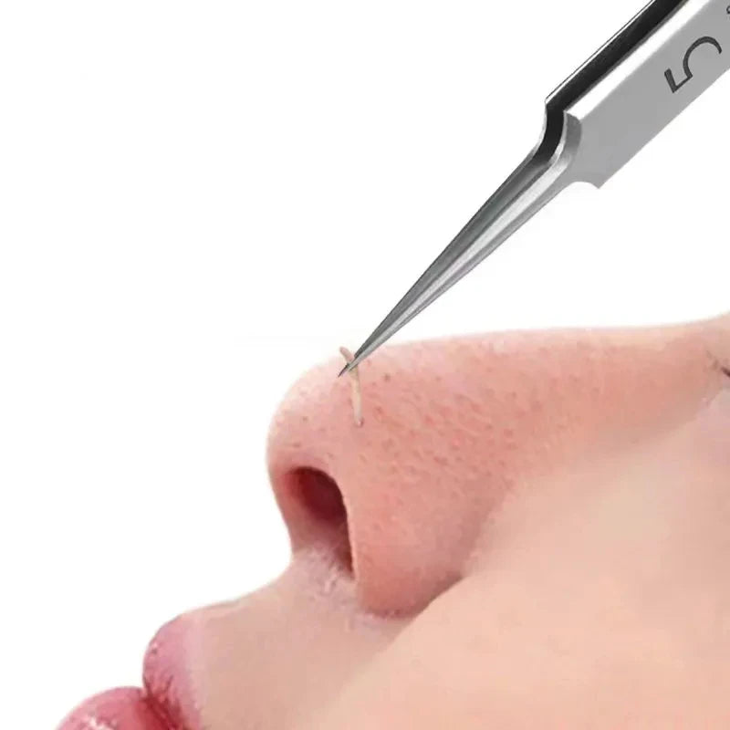Ultra-Fine Blackhead Extractor Tweezer | Salon Precision Tool Blackhead Extractor Tool QXL