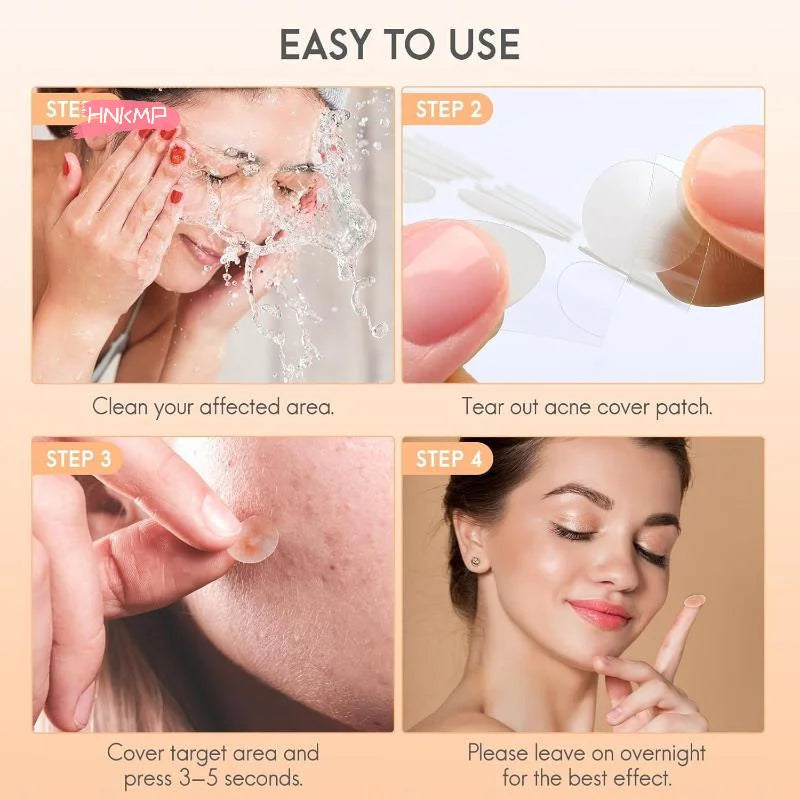 128-Pack Hydrocolloid Acne Patches | Invisible Salicylic Dots Acne Patch Set QXL