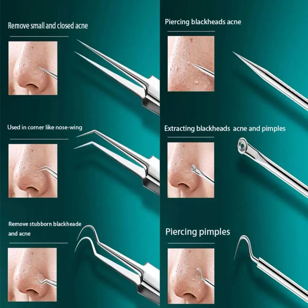 8-Piece Blackhead Remover Tool Set | Pore Cleansing Kit Blackhead Remover Set QXL