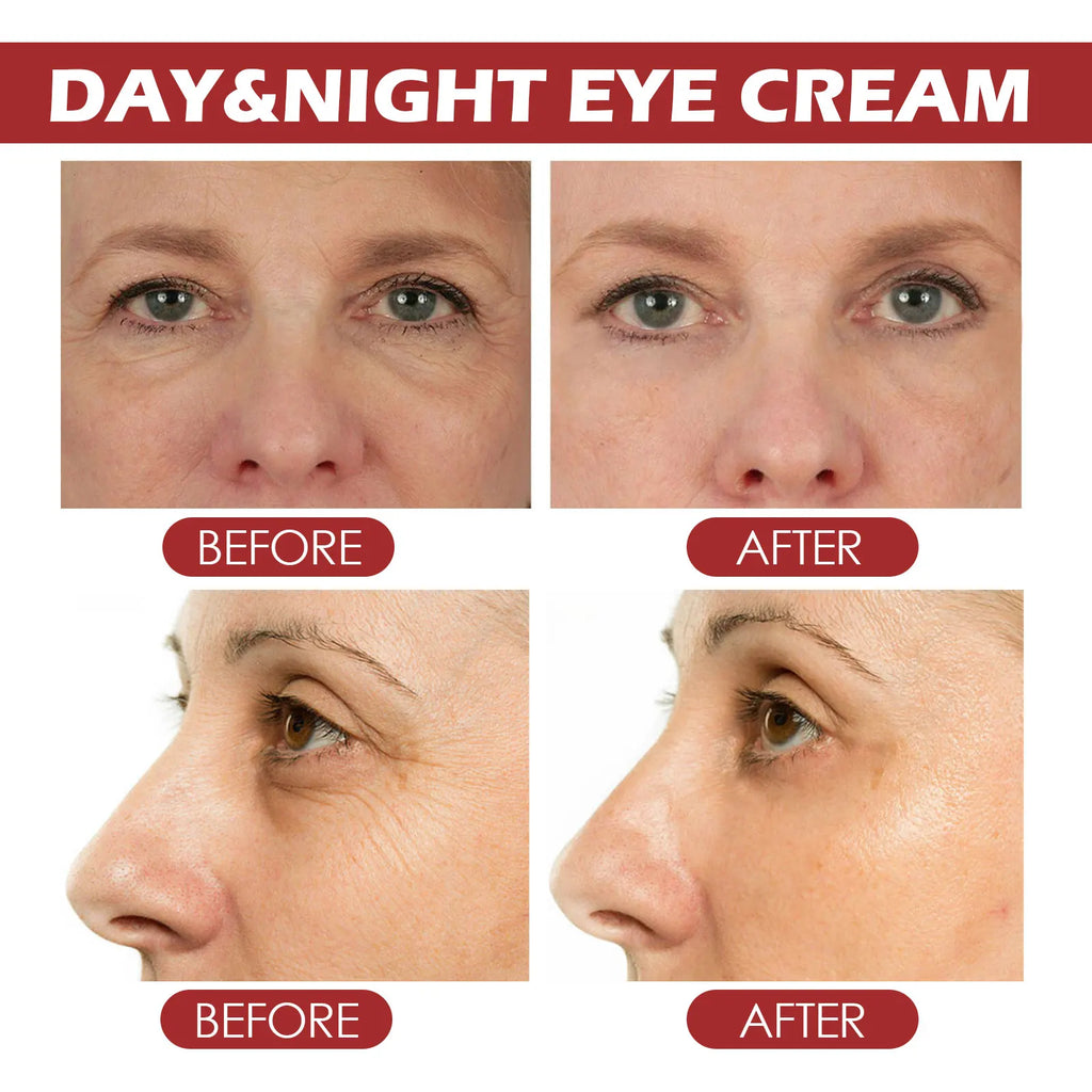 Hoygi Retinol Eye Cream Stick | Collagen & Hyaluronic Acid Eye Cream Stick QXL