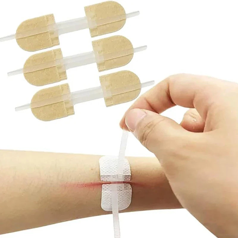 Butterfly Closure Bandage Strips | Adhesive Wound Closure Patches Wound Closure Strips QXL