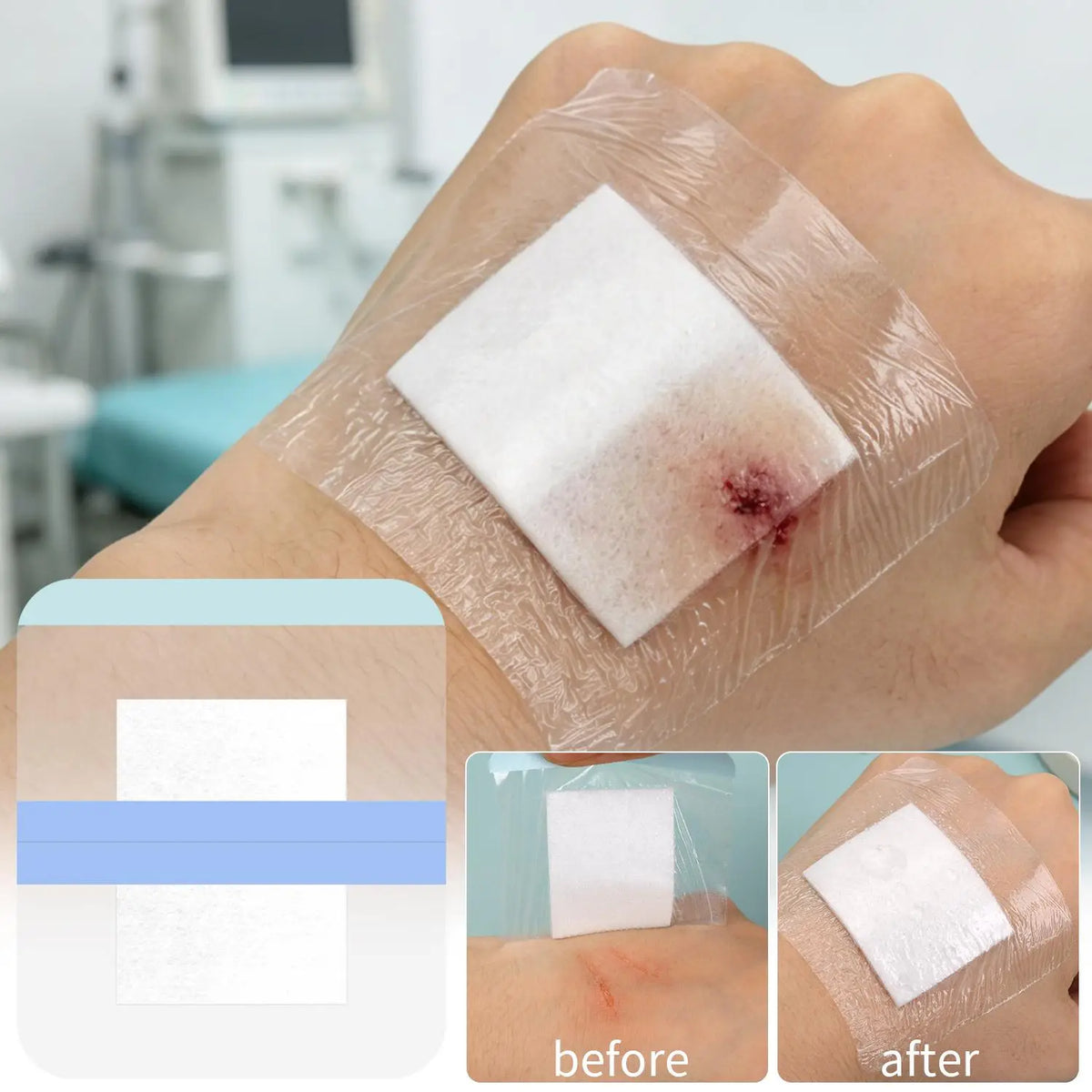 Clear PU Wound Dressing Patches | Waterproof Adhesive Bandages Wound Dressing Patch QXL