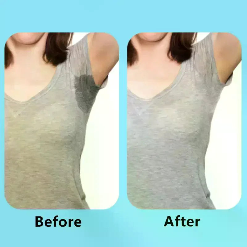 Underarm Sweat Pads Skin-Tone Odor Control 5/10 Pack Underarm Sweat Pads QXL