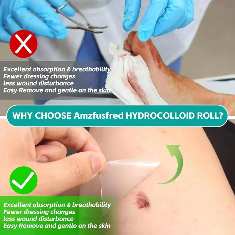 Hydrocolloid Roll Bandage | Self-Adhesive Wound Dressing 5×150cm Wound Dressing Roll QXL