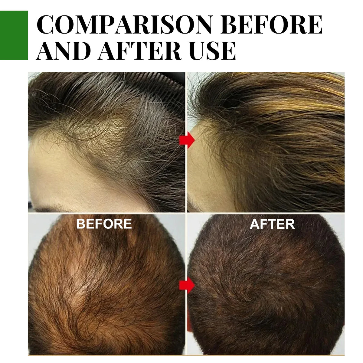 HOEGOA Rosemary Hair Oil – Shine, Frizz Control & Scalp Care Hair Essential Oil QXL