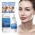 Hyaluronic Acid Essence – Moisturizing & Firming Face Serum Facial Essence Serum QXL 60ml
