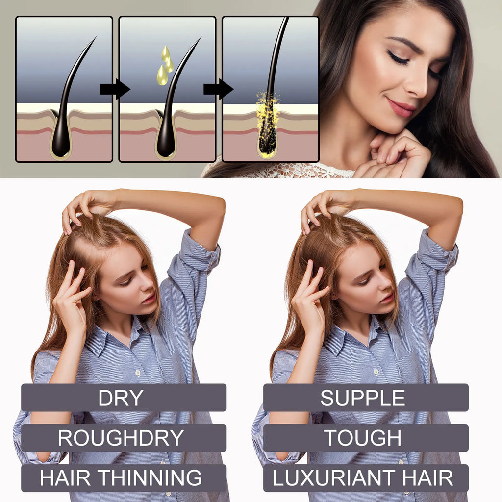 HOEGOA Biotin Collagen Scalp Serum | Rosemary Hair Oil 30ml Scalp Hair Serum QXL