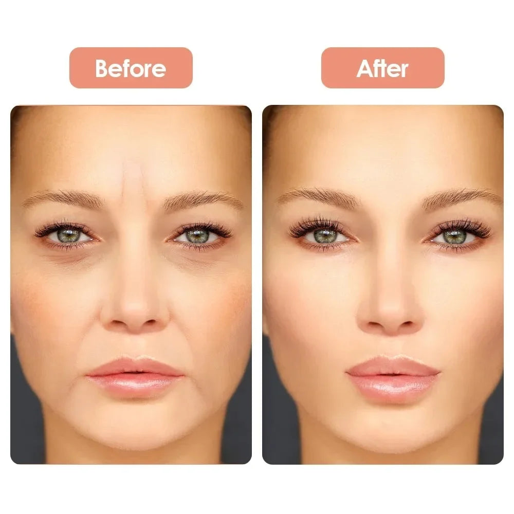 Reusable Silicone Anti-Wrinkle Patches | Face, Neck & Eye Silicone Wrinkle Patches QXL