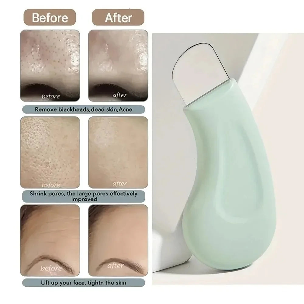 Silicone Blackhead Remover & Facial Pore Cleansing Scraper Facial Cleansing Scraper QXL