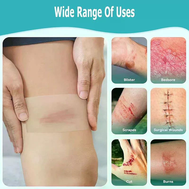 Hydrocolloid Wound Care Roll Bandage – Self-Adhesive & Waterproof Hydrocolloid Bandage Roll QXL