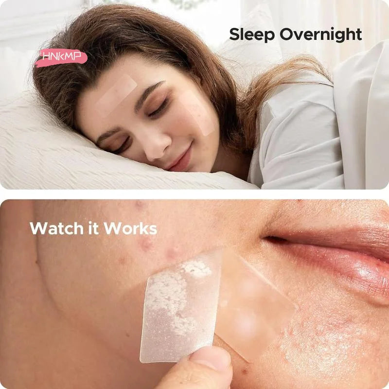 128-Pack Hydrocolloid Acne Patches | Invisible Salicylic Dots Acne Patch Set QXL