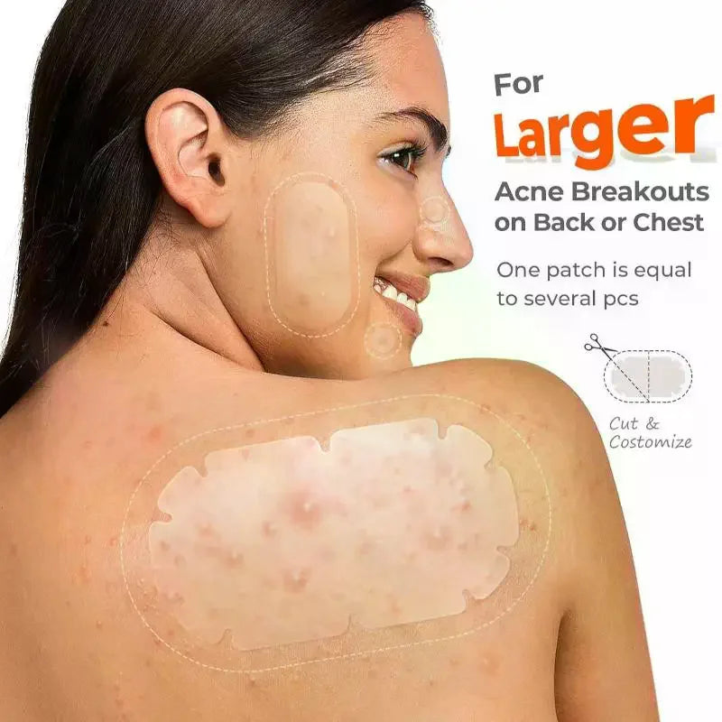 Bulk Hydrocolloid Pimple Patches Multi-Shape 104/376 Pcs Pimple Patches QXL