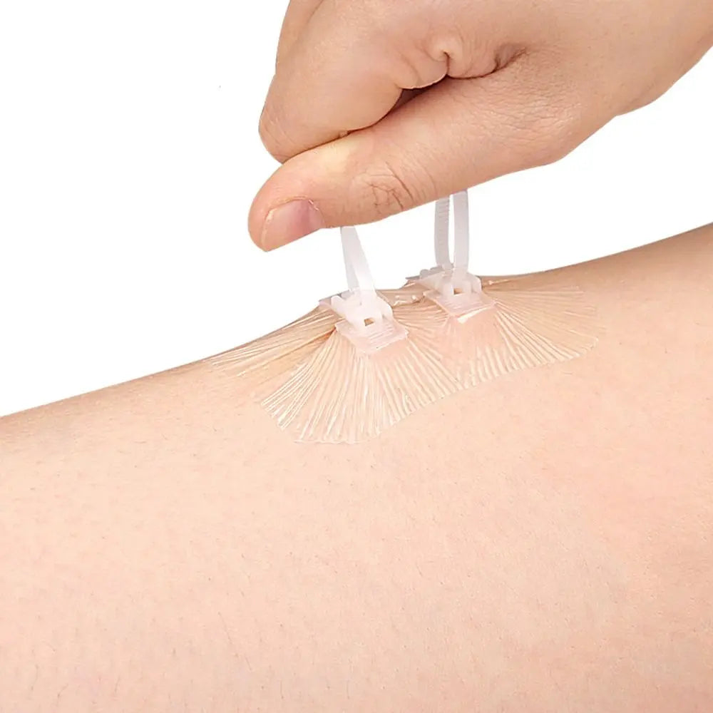 Zip Suture Wound Closure Strips | No-Stitch First Aid Bandage Wound Closure Strips QXL