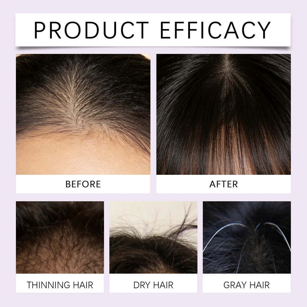 HOEGOA Fig & Biotin Nourishing Hair Serum 30ml Hair Serum QXL