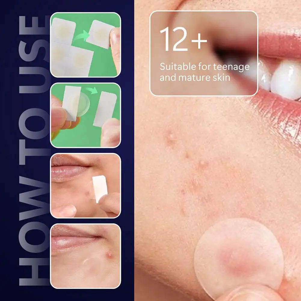 24-Pack Invisible Microneedle Blemish Patches for Face Spots Microneedle Blemish Patches QXL