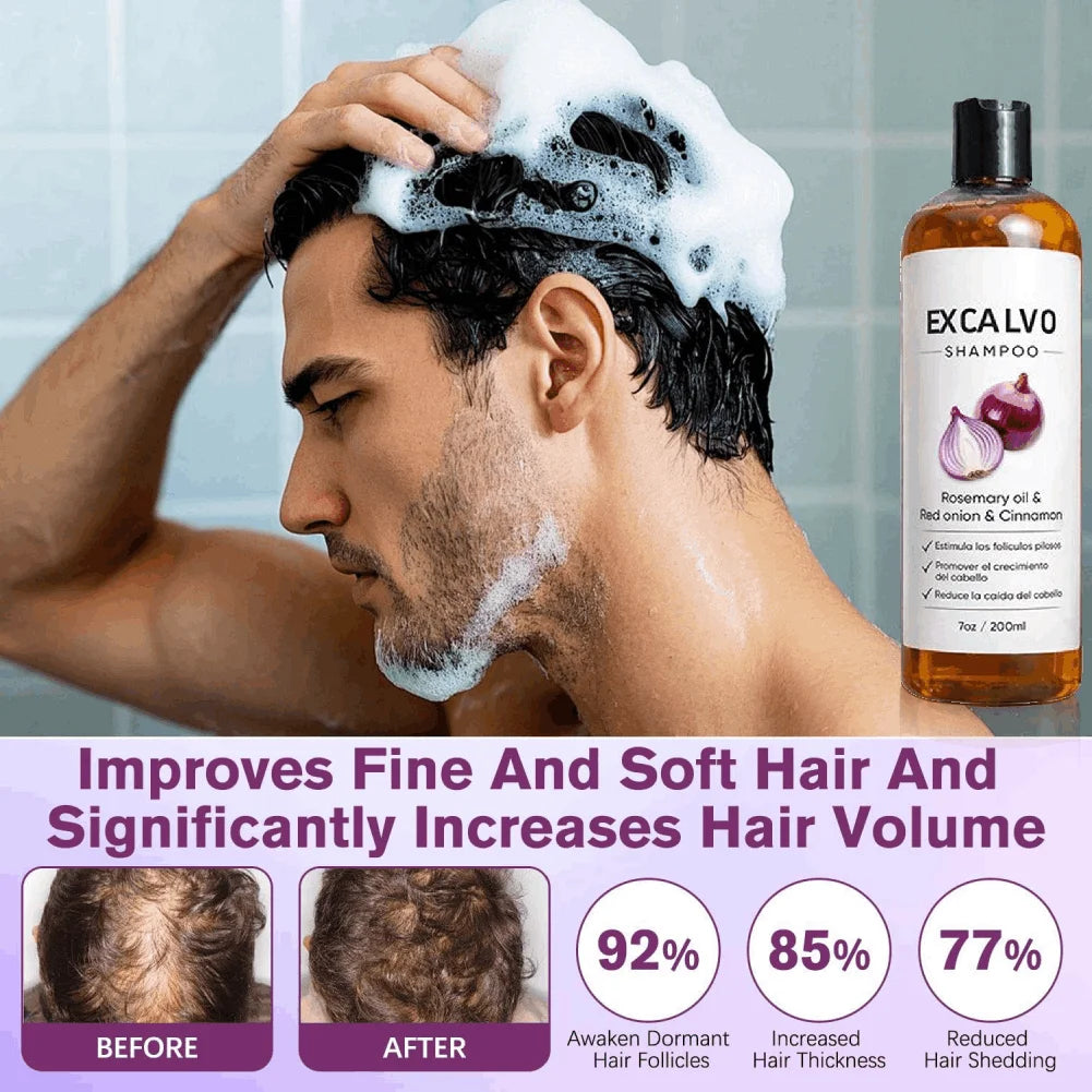 Rosemary & Red Onion Strengthening Shampoo 200ml | Nourishing Nourishing Shampoo QXL