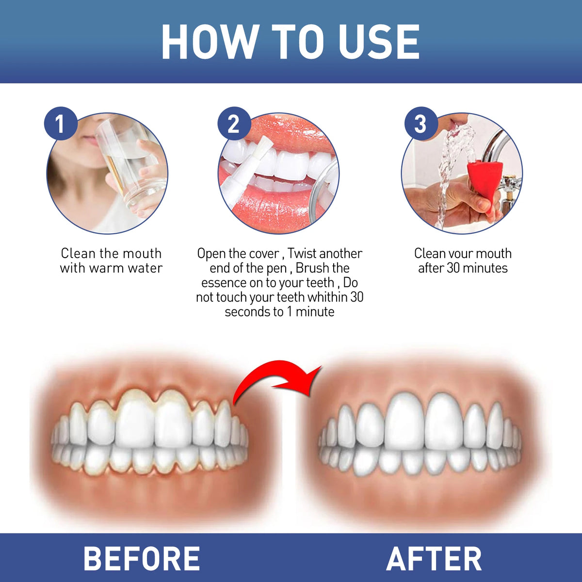 Gum Care & Repair Gel – Deep Clean, Whiten & Protect Gums Gum Care Gel QXL