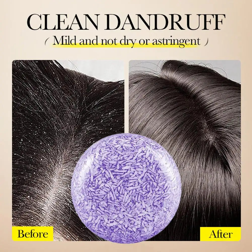 SADOER Lavender Solid Shampoo Bar – Scalp Care & Volume Solid Shampoo Bar QXL