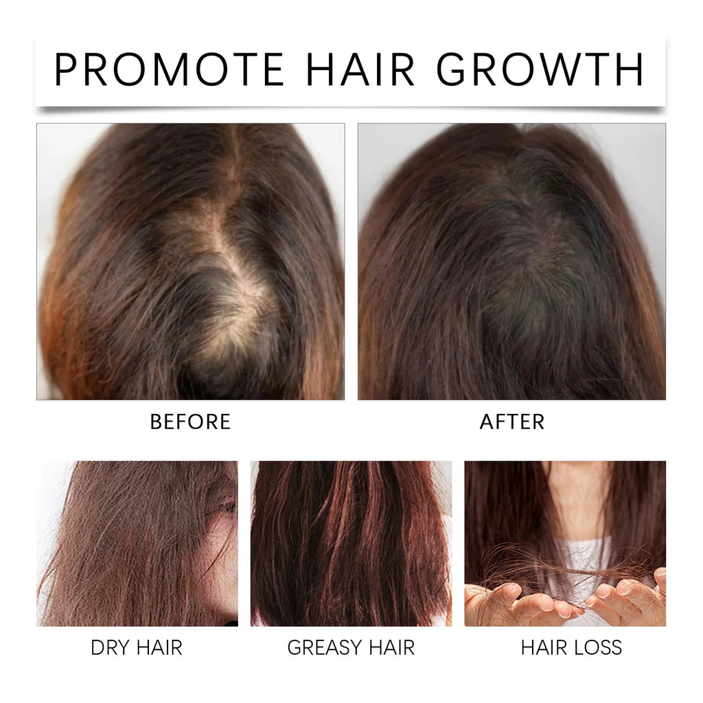HOEGOA Palm Oil Hair Growth & Scalp Treatment Oil 60ml Scalp Treatment Oil QXL
