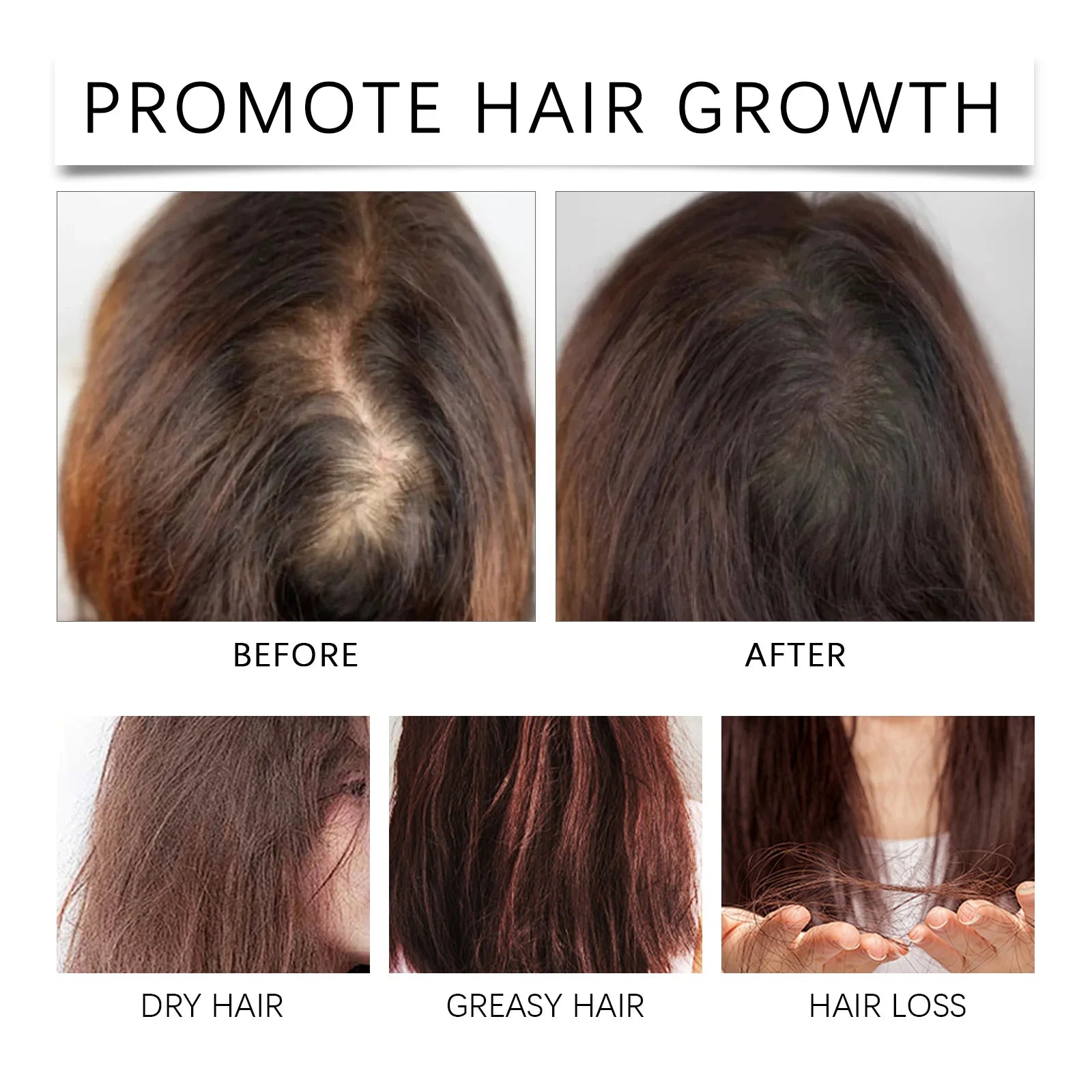 HOEGOA Palm Oil Hair Growth & Scalp Treatment Oil 60ml Scalp Treatment Oil QXL