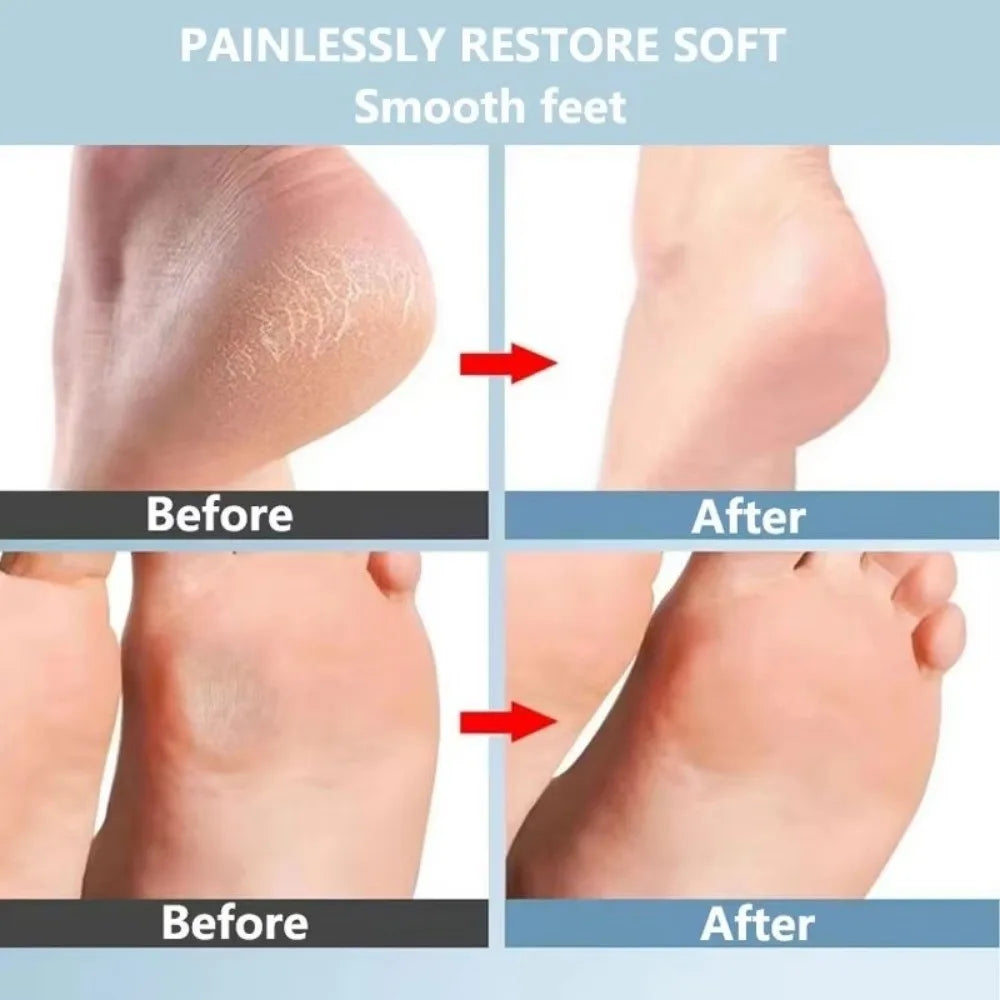 Nanoglass Oval Foot File & Callus Remover | Heel Scrubber Foot File QXL