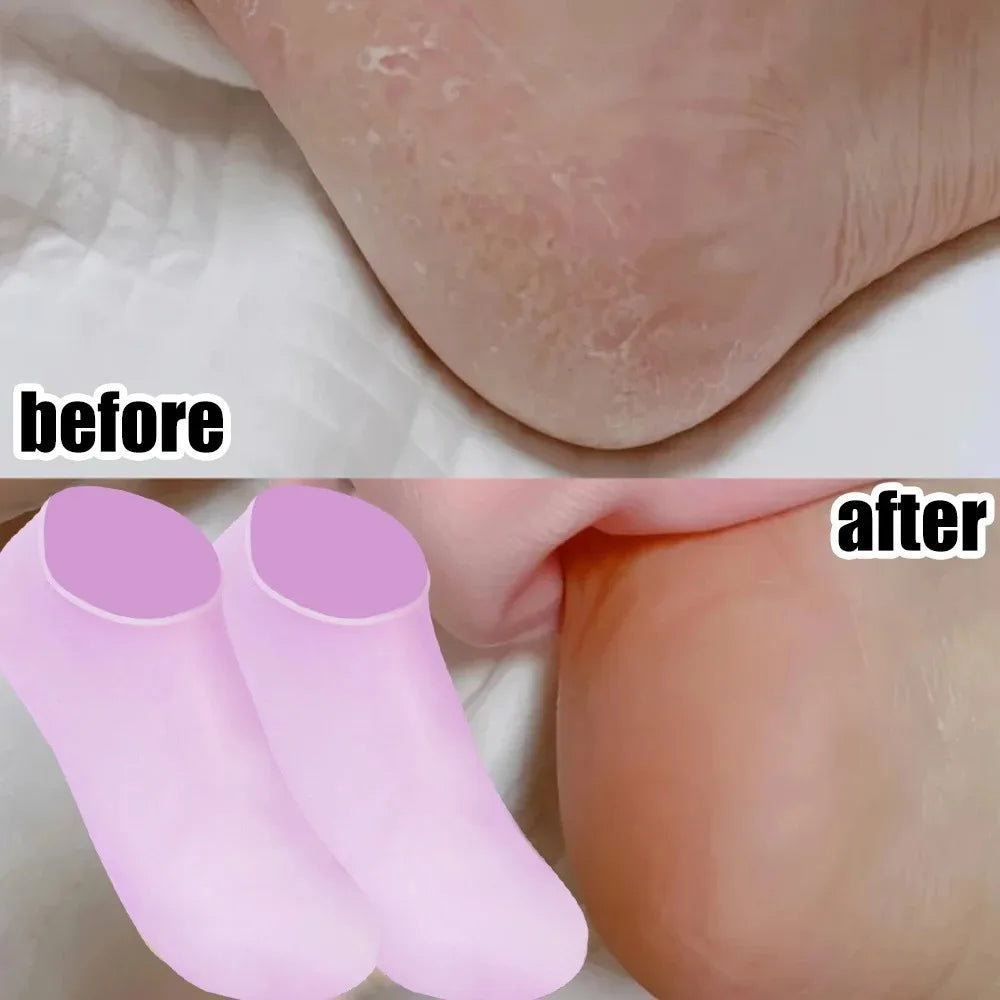 Silicone Moisturizing Foot Socks | Anti-Crack Dry Skin Care Moisturizing Foot Socks QXL
