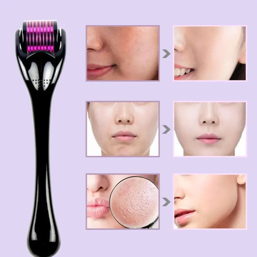 540 Needle Derma Roller – Collagen & Skin Tightening Tool Derma Roller QXL