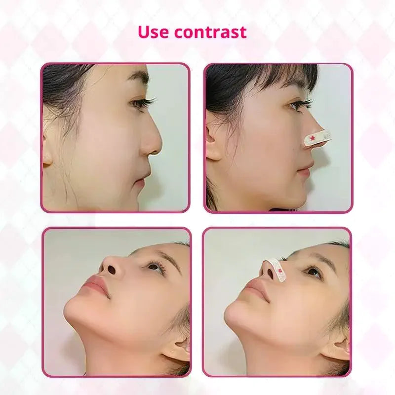Nose Reshaping Patches | Memory Support Shaping Strips 5–30pc Nose Shaping Strips QXL