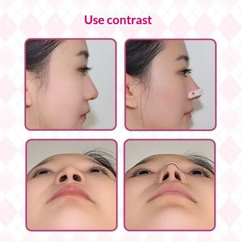 Adjustable Nose Lift Shaping Strips | Breathable Alar Slimming Nose Shaping Strip QXL