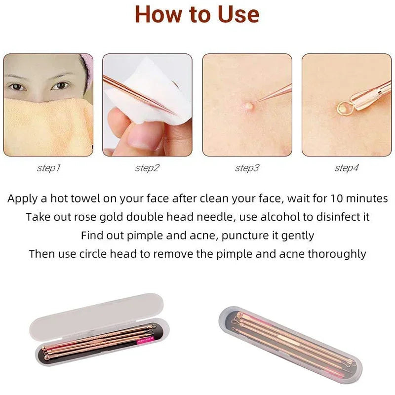4-Piece Stainless Steel Blackhead & Blemish Removal Tool Set Blemish Extraction Kit QXL