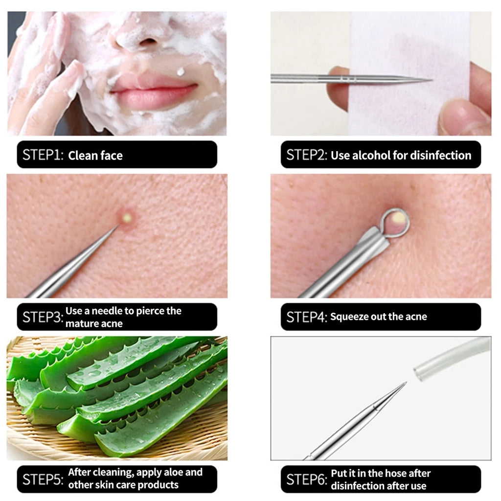 4-Piece Blackhead Extractor Tool Set | Stainless Steel Skin Care Blackhead Extractor Set QXL