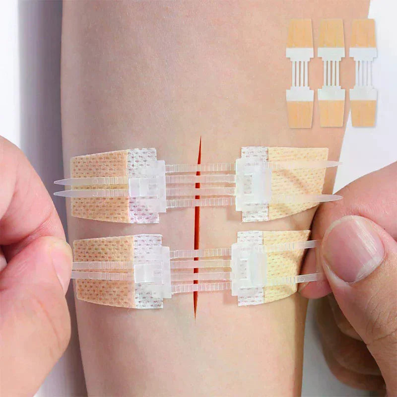 Zipper Wound Closure Patch | Suture-Free Emergency Bandage Wound Closure Patch QXL
