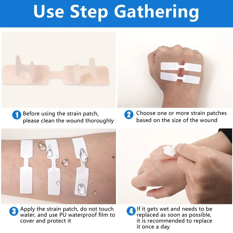 Butterfly Closure Bandage Strips | Adhesive Wound Closure Patches Wound Closure Strips QXL