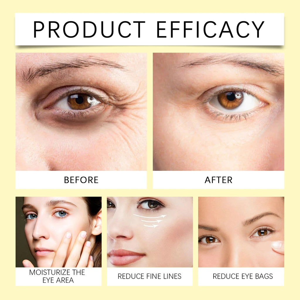 WIYUN Bee Venom Eye Cream – Anti-Wrinkle & Moisturizing Eye Cream QXL