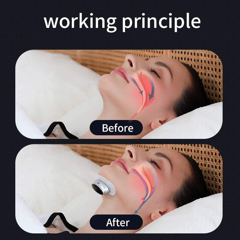 Dual-Pulse Anti-Snore Device | Quiet Sleep Aid, CE Certified Anti-Snore Sleep Device QXL