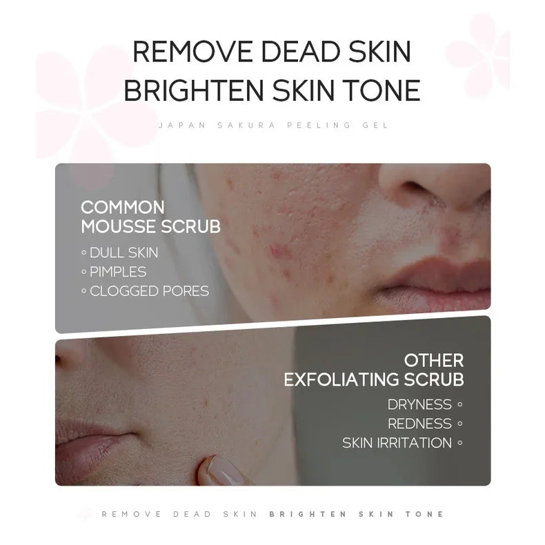 LAIKOU Sakura Peeling Gel Facial Exfoliator 60g Facial Peeling Gel QXL