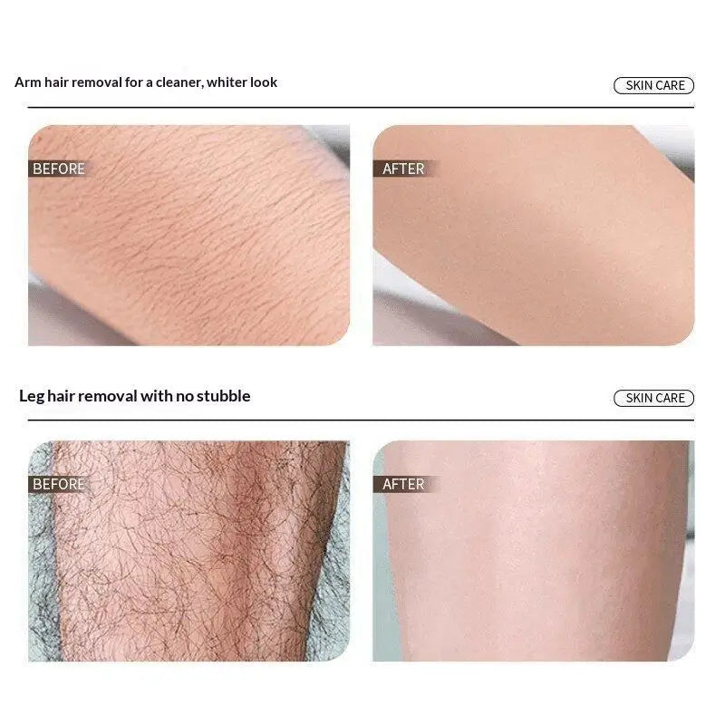 Nano Crystal Hair Eraser | Reusable Hair Removal Tool Crystal Hair Eraser QXL