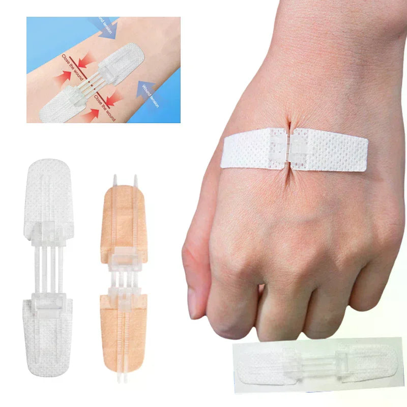 Zipper Wound Closure Patch | Suture-Free Emergency Bandage Wound Closure Patch QXL