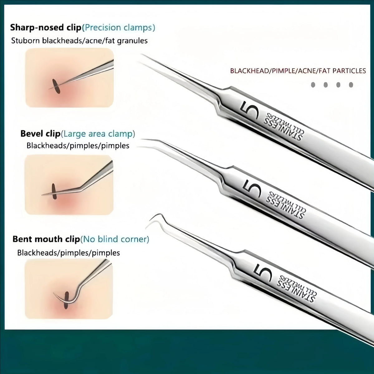 8-Pc Stainless Steel Blackhead & Acne Extractor Tool Kit Acne Extractor Kit QXL